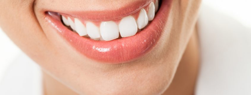 Efek Menggunakan Pemutih Gigi